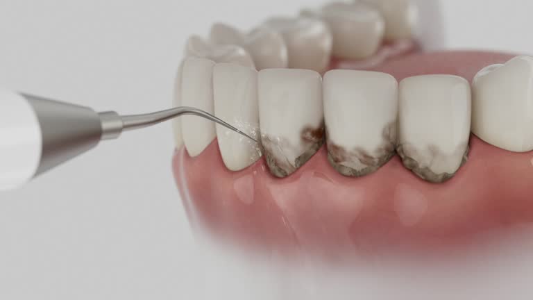 Reliable Dental Implants contractor in Crown Heights, NY by Smile Center Dentistry